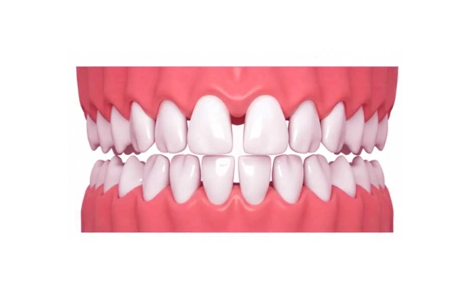 clinicadoctormahdi, Aparat dentar