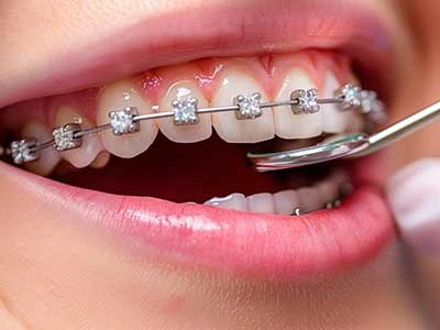 clinicadoctormahdi, Tratamente stomatologice, aparate dentare, dinti ficsi in 24 ore