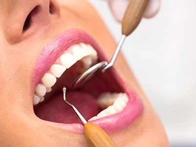 clinicadoctormahdi, Tratamente stomatologice, aparate dentare, dinti ficsi in 24 ore