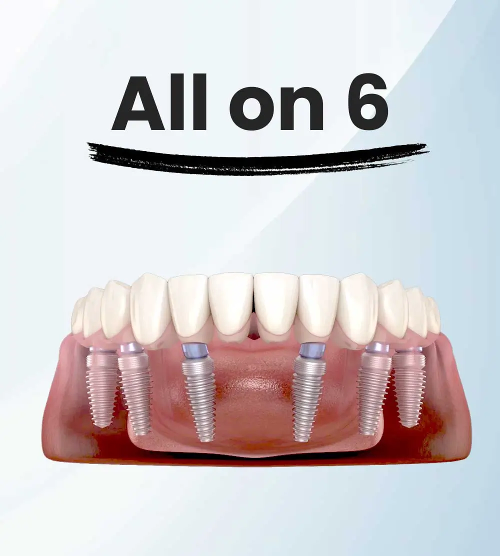 clinicadoctormahdi, Tratamente stomatologice, aparate dentare, dinti ficsi in 24 ore