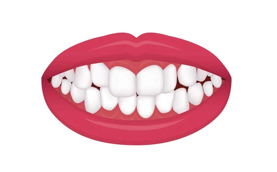 clinicadoctormahdi, Aparat dentar