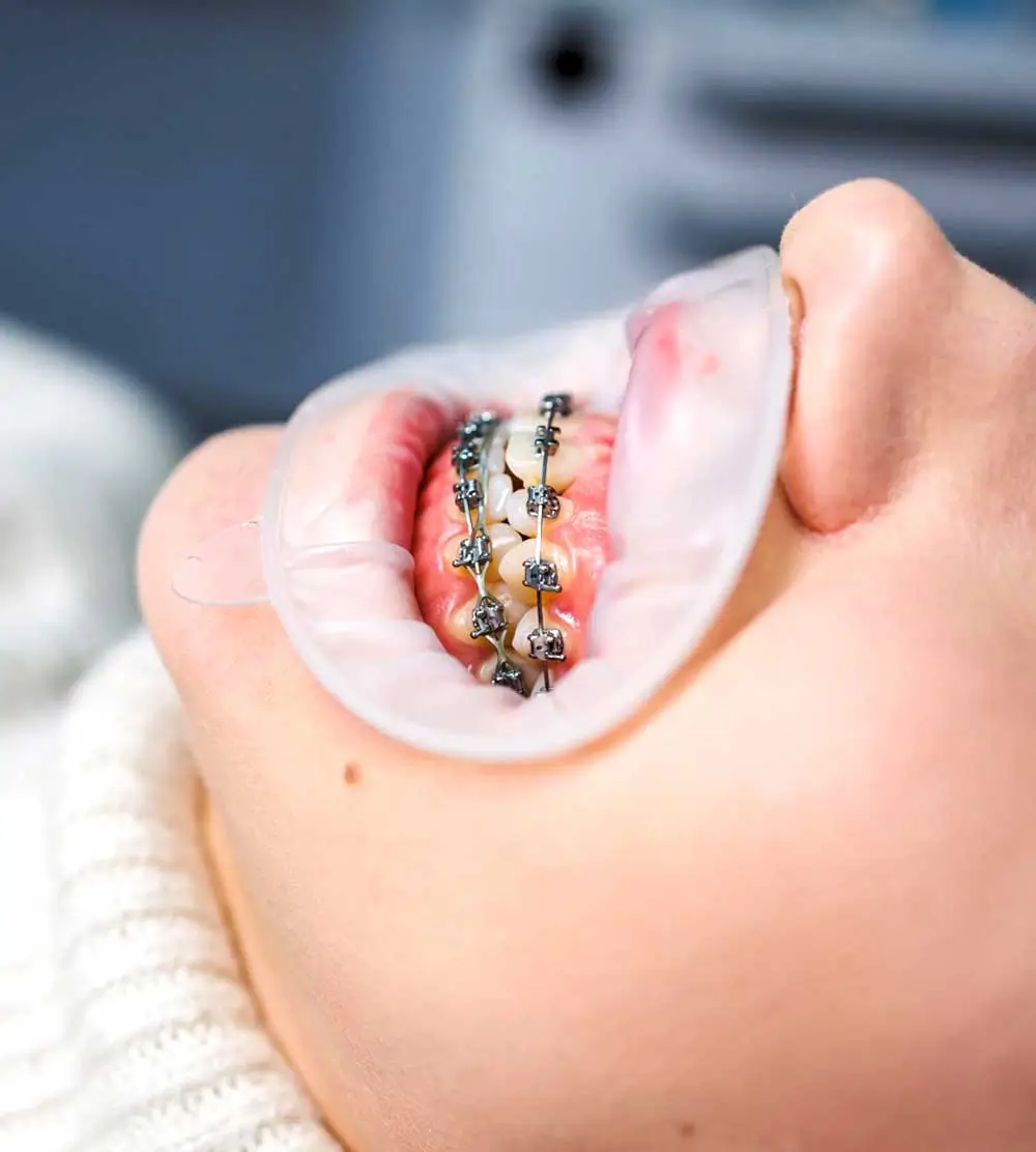 clinicadoctormahdi, Aparat dentar